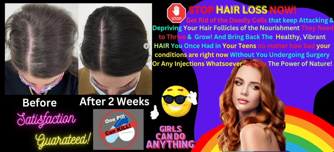 hairloss treatment 3