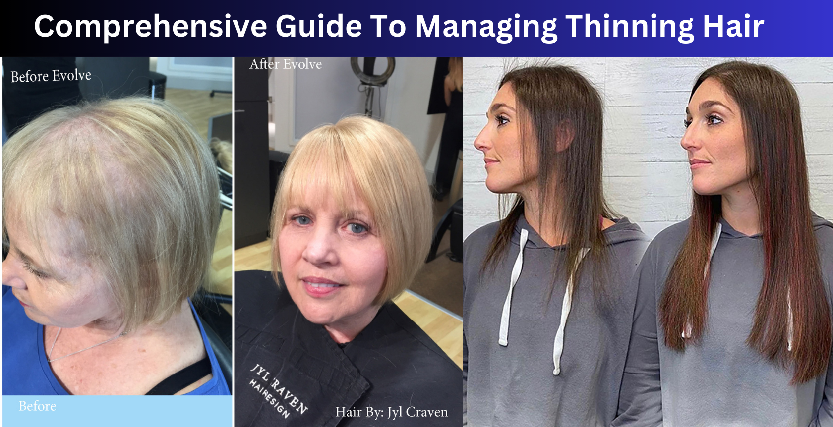 Hair Thinning Hair Thinning